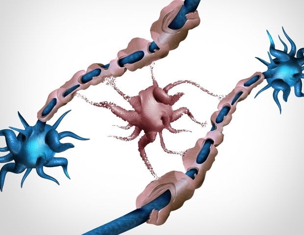 Faulty myelin-making brain cells may help drive cognitive decline with age