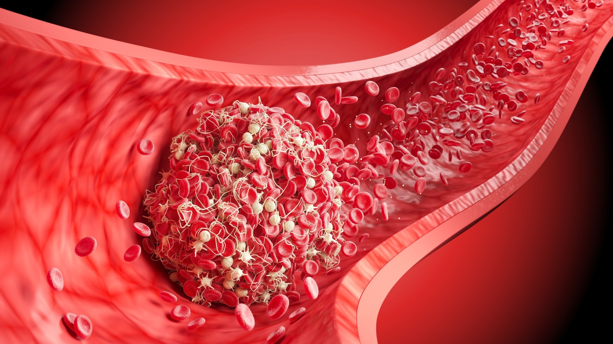 Study: Searching for biomarkers of long COVID: findings from a nationwide population-based study. Image Credit: Anusorn Nakdee / Shutterstock