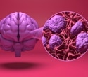 Blood-brain barrier-crossing blood pressure drugs linked to lower dementia risk