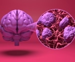Blood-brain barrier-crossing blood pressure drugs linked to lower dementia risk