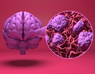 Blood-brain barrier-crossing blood pressure drugs linked to lower dementia risk