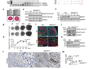 Primate-specific DNA change reveals a new link to dementia-related neurodegeneration