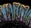 Researchers identify early molecular warning signs of inflammatory bowel disease