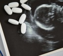 Researchers found one childhood behavior linked to folic acid use before pregnancy