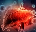 Alcohol-related liver cancer deaths were falling. Then the trend reversed during the COVID-19 pandemic