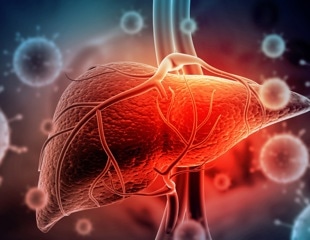 Alcohol-related liver cancer deaths were falling. Then the trend reversed during the COVID-19 pandemic