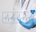 AI learned from cardiologists’ notes, and needed far less labeled ECG data
