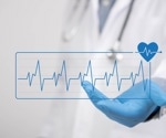 AI learned from cardiologists’ notes, and needed far less labeled ECG data