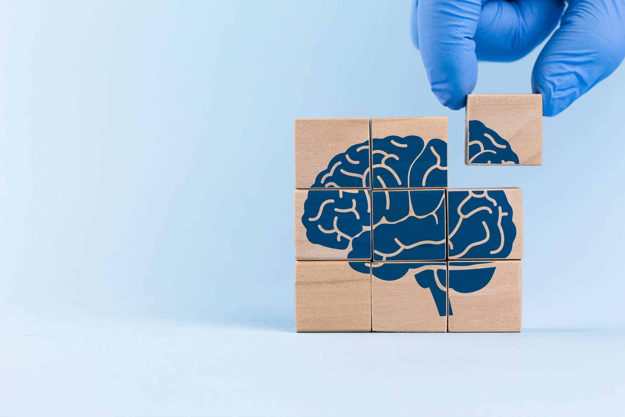 Study: Priming of CD8+ T cells by peripheral dendritic cells exacerbates tau-mediated neurodegeneration. Image Credit: Antonio Marca / Shutterstock
