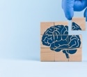 Scientists traced a hidden immune route that may worsen tau-linked brain damage