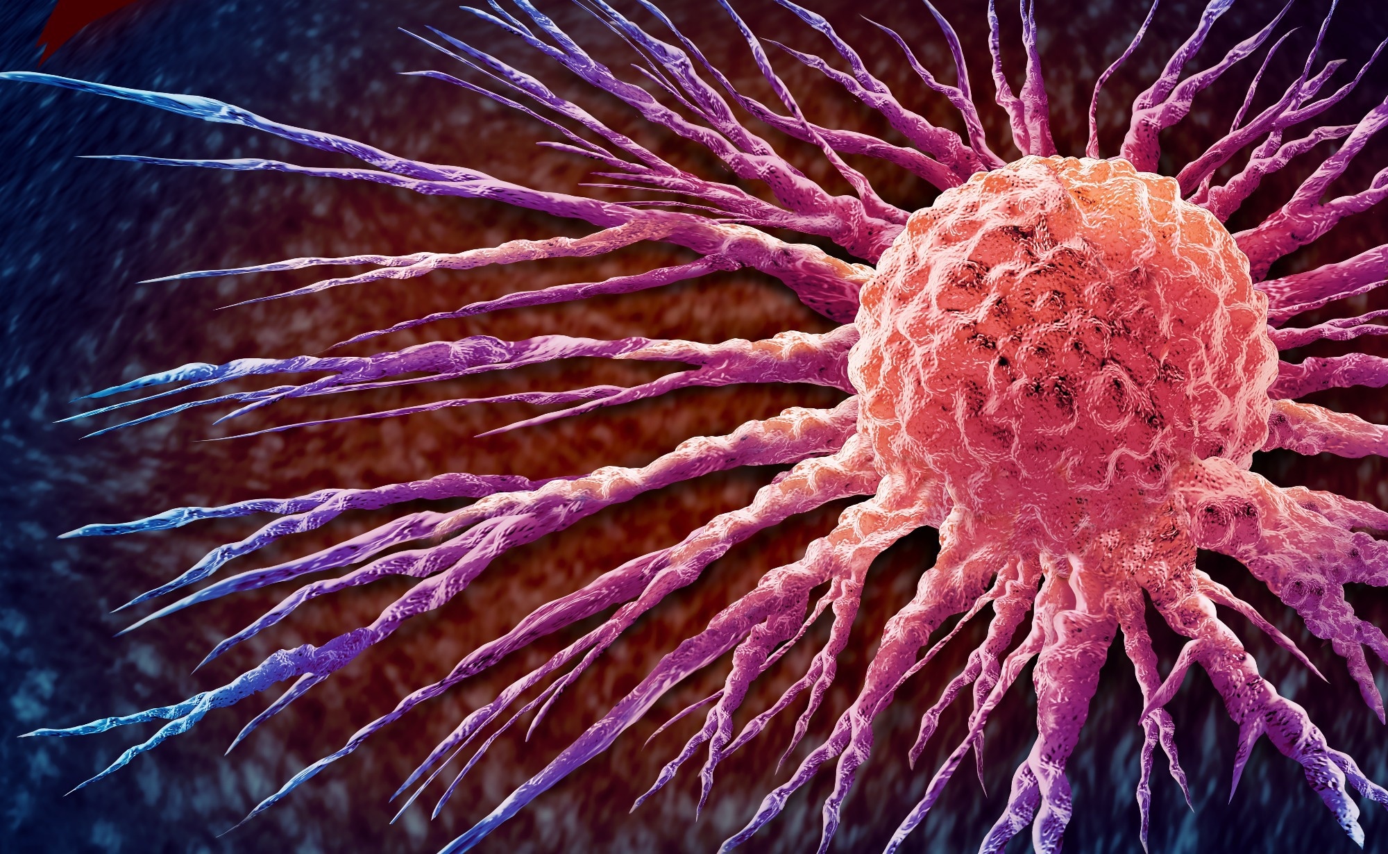 A comparative study of large language models in responding to breast cancer–related questions. Image Credit: Lightspring / Shutterstock