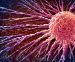 Breast cancer AI test finds no single chatbot excels across every measure