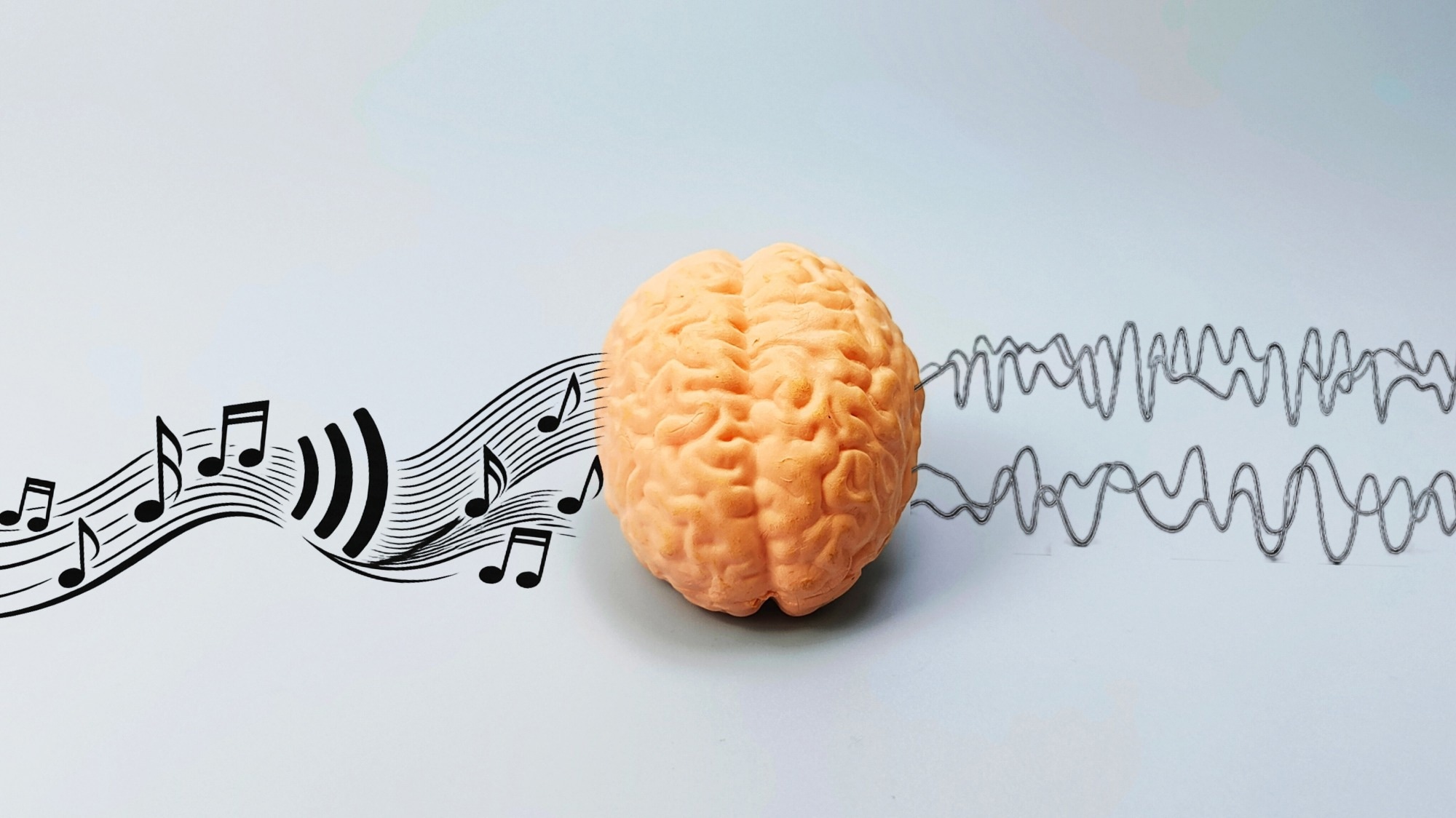 The music in psychedelic therapy may be more than background sound