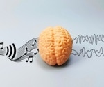 The music in psychedelic therapy may be more than background sound