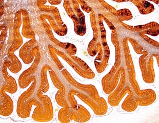 Some mice showed signs of stress resilience before the stress even began