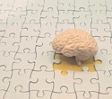 Better fitness was linked to healthier brain structure, but not better memory
