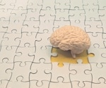 Better fitness was linked to healthier brain structure, but not better memory