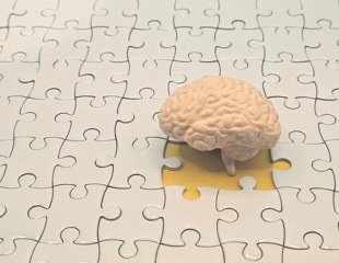 Better fitness was linked to healthier brain structure, but not better memory