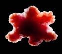 Transplanted human cortical organoids filled most of a mouse cortex. Then they began to connect
