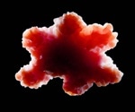 Transplanted human cortical organoids filled most of a mouse cortex. Then they began to connect