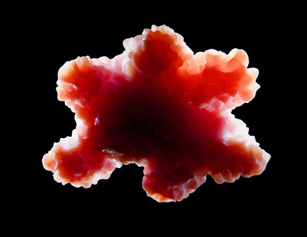 Transplanted human cortical organoids filled most of a mouse cortex. Then they began to connect