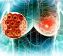 Why might a higher BMI at 20 be linked to lower breast cancer risk later in life?
