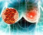 Why might a higher BMI at 20 be linked to lower breast cancer risk later in life?