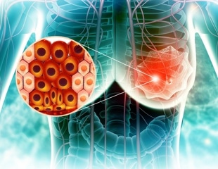 Why might a higher BMI at 20 be linked to lower breast cancer risk later in life?