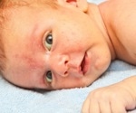 Common chemical exposures in pregnancy may be linked to early attention and memory