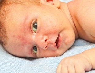 Common chemical exposures in pregnancy may be linked to early attention and memory