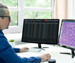Leica Biosystems brings Tempus pathology products to Aperio AI Store, accelerating AI-powered capabilities for oncology research
