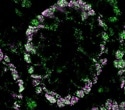 MolBoolean™ measures free and bound proteins in the same experiment
