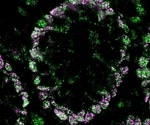 MolBoolean™ measures free and bound proteins in the same experiment