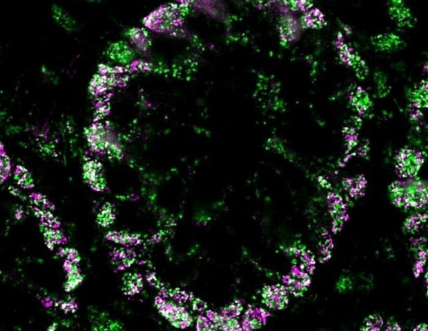 MolBoolean™ measures free and bound proteins in the same experiment