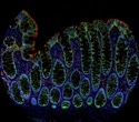 AtlasPlex™ brings custom 5-plex IHC on FFPE tissue into a single day