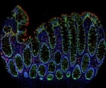 AtlasPlex™ brings custom 5-plex IHC on FFPE tissue into a single day