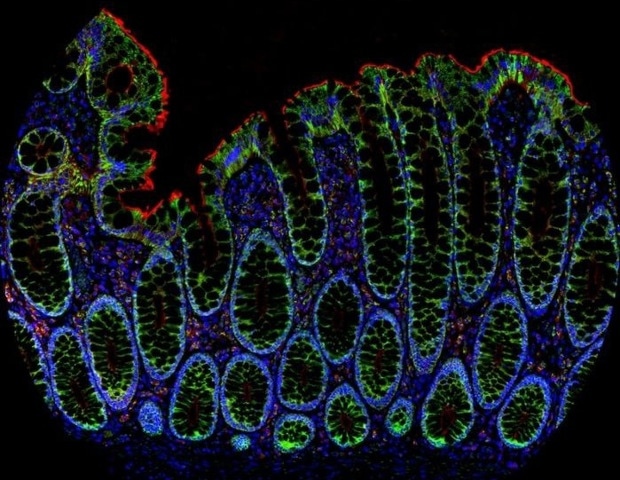 AtlasPlex™ brings custom 5-plex IHC on FFPE tissue into a single day