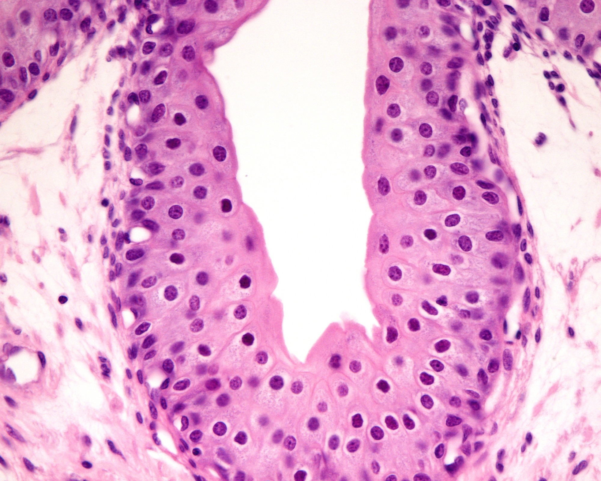 Transitional epithelium (urothelium) of the ureter. The epithelium shows a basal cell layer 2-3 intermediate cell layers and large superficial cells.