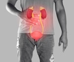 A New Approach to Preventing Bladder Cancer Recurrence