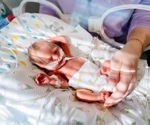 Daily probiotics help prevent severe gut disease in preterm babies