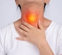 Esophageal cancer leaves a distinct metabolic signature in the gut