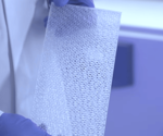 Developing biomaterials for soft tissue reconstruction