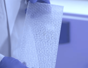 Developing biomaterials for soft tissue reconstruction
