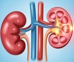 Is a high-protein diet hard on your kidneys?