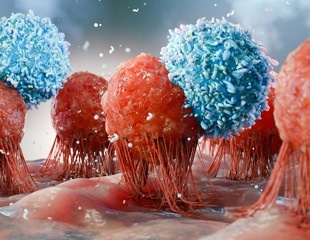 Infections caused 1 in 8 cancer cases worldwide in 2024, study finds