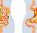 Body fat distribution may influence hunger hormones more than daily diet