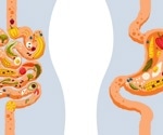 Body fat distribution may influence hunger hormones more than daily diet