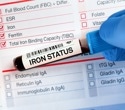 New iron deficiency guidelines raise key blood test cutoffs