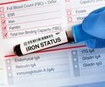 New iron deficiency guidelines raise key blood test cutoffs