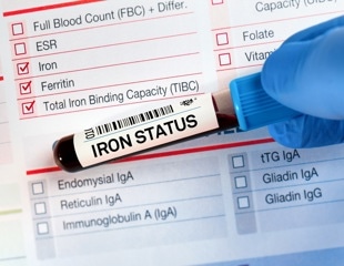 New iron deficiency guidelines raise key blood test cutoffs